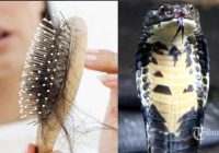 Apakah Ular Memiliki Rambut?