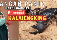 pertolongan pertama sengatan KALAJENGKING Dirumah - YouTube